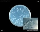 Staphy.epidermidis colony